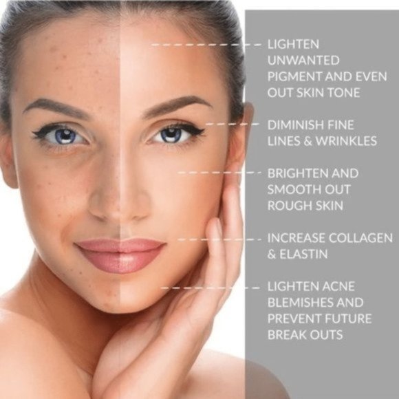 NEW Natural Pink Jade Roller for Glowing Skin - Picture 5 of 8